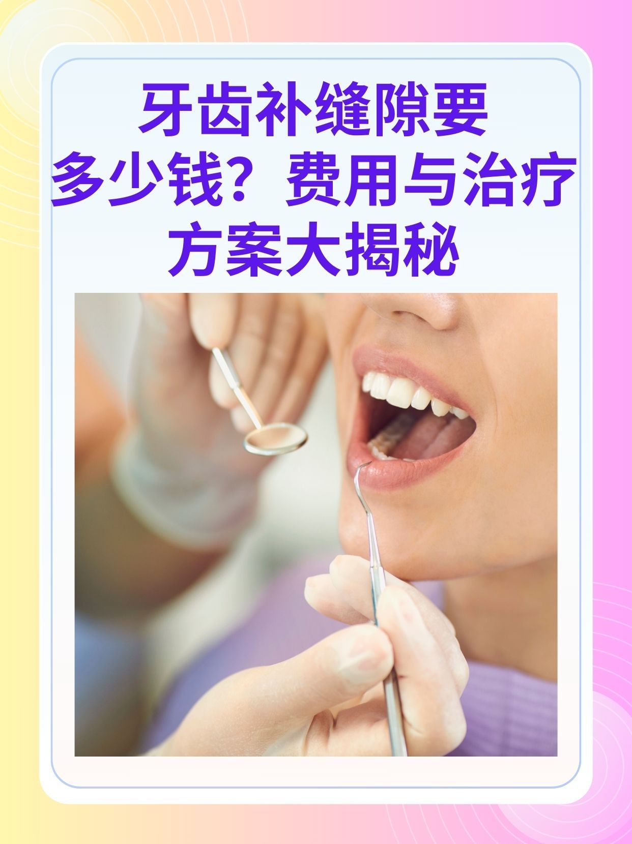 襄樊补牙医保可以报销吗(补牙医保可以报销吗 哪些可以报销呢)